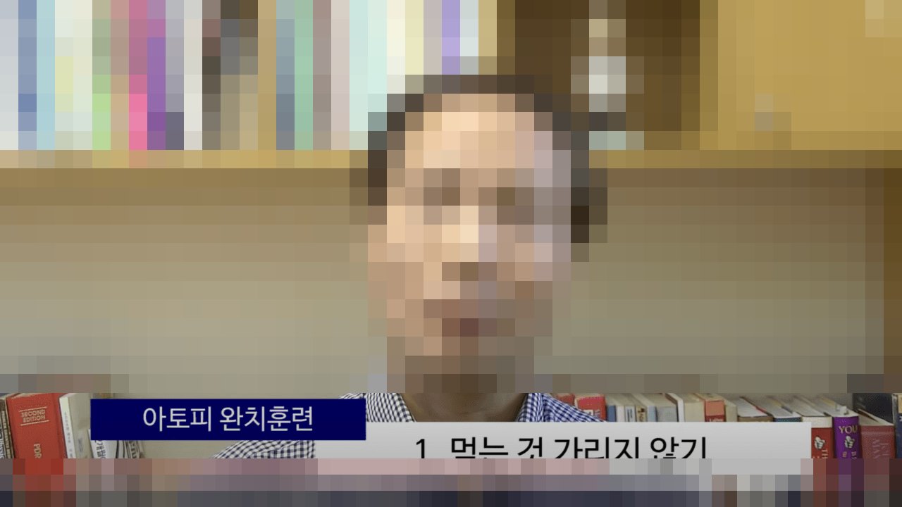 아토피 완치훈련 — 1. 먹는 것 가리지 않기